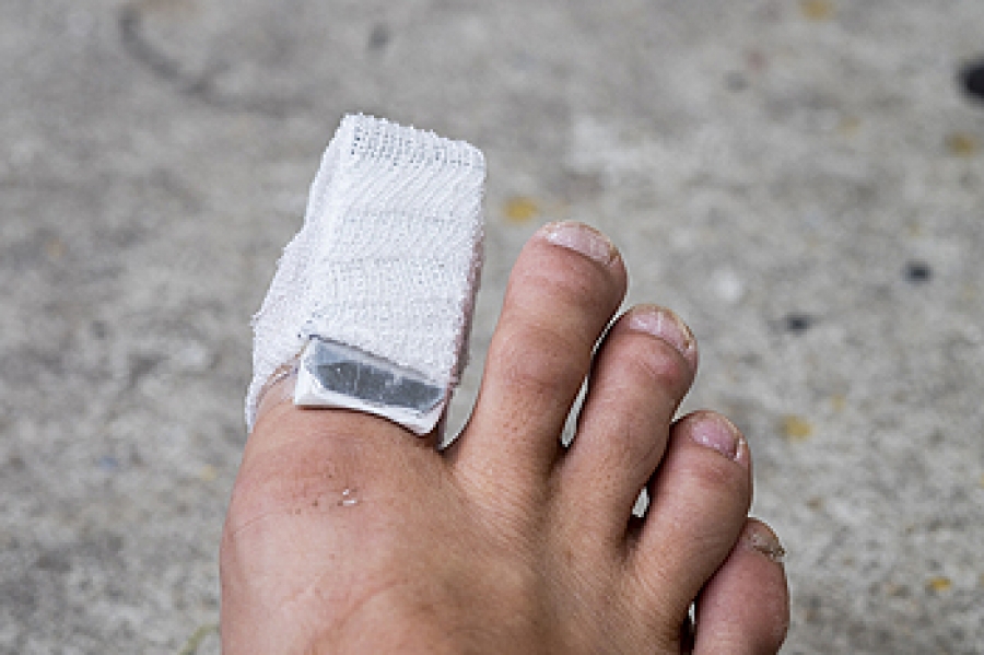 How Long Does A Broken Toe Take To Heal 